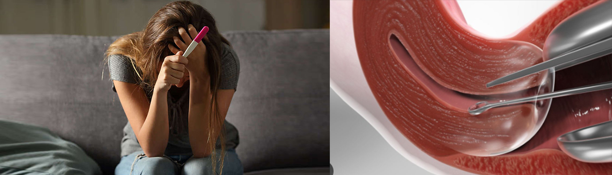 namjerniPrekidTrudnoceWeb